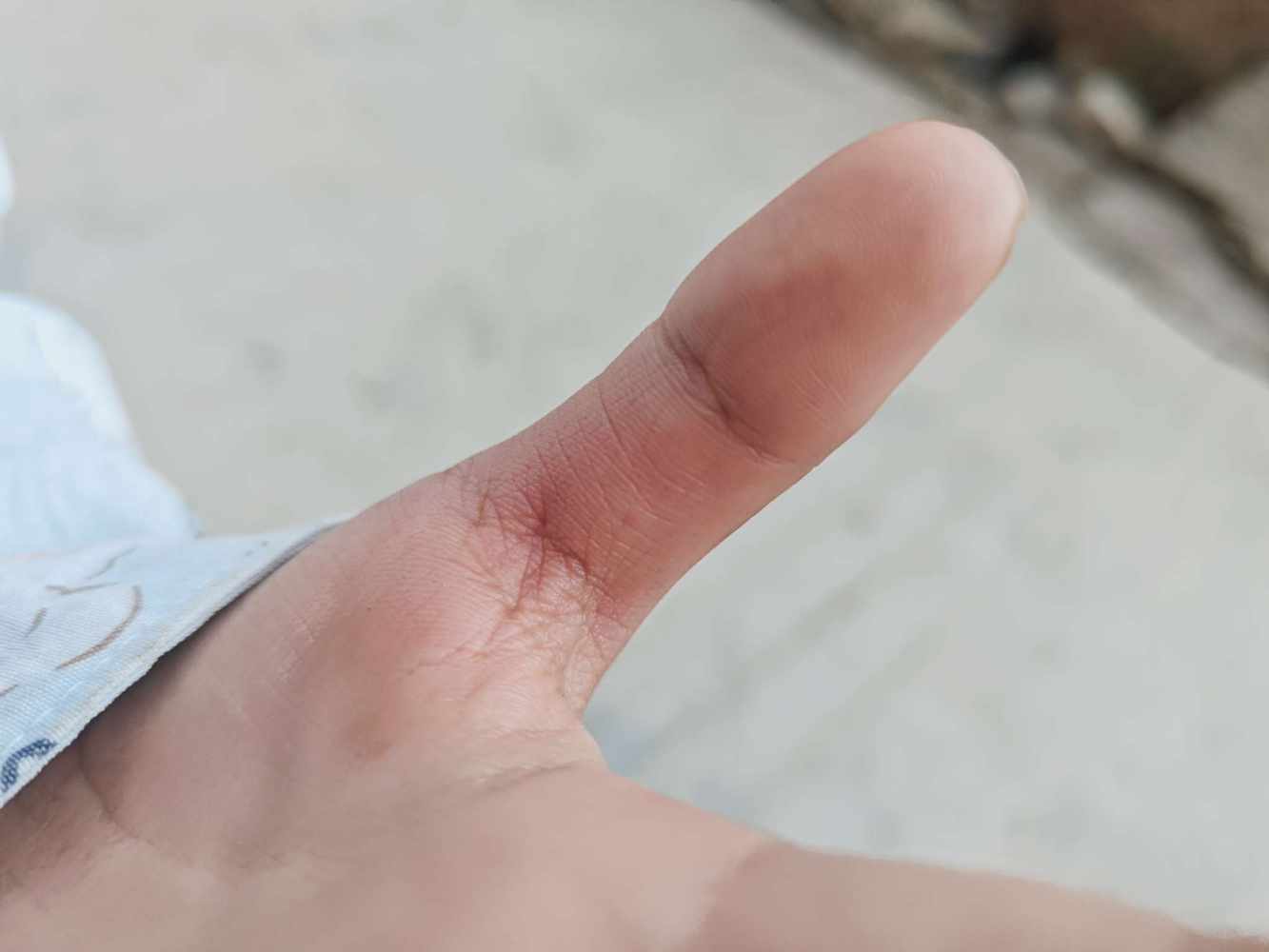 天 真发布的第1张图片