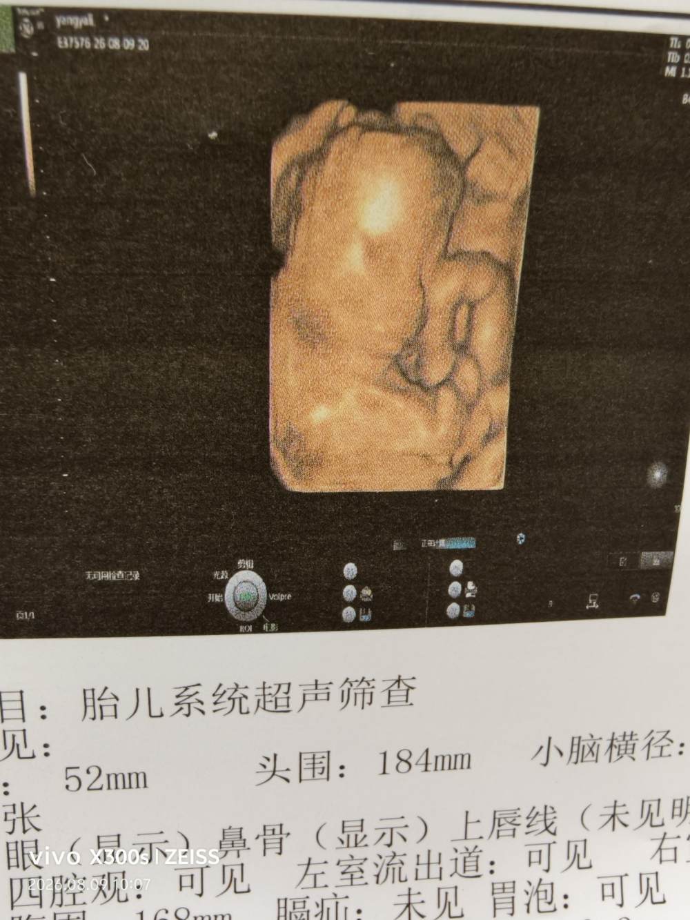 周颜秋（不是陪，不接）发布的第2张图片